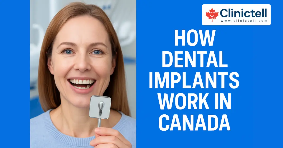 Dental Implants Work in Canada